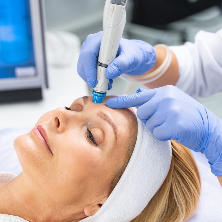 14_Hydrodermabrasion_shutterstock_1731136468