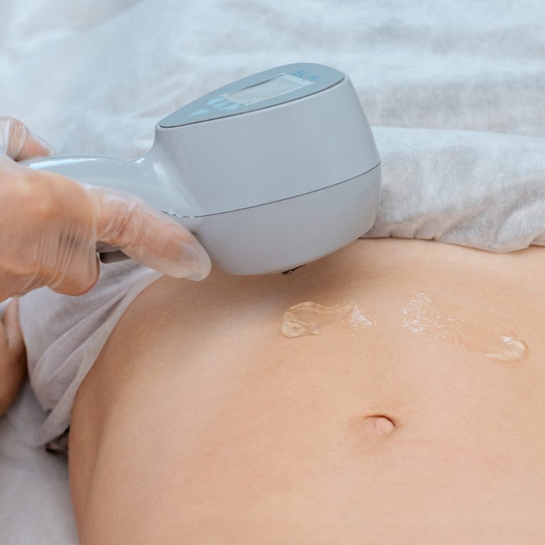 EXILIS RF_1